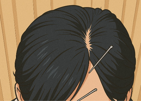 44歲女性-多發性硬化症